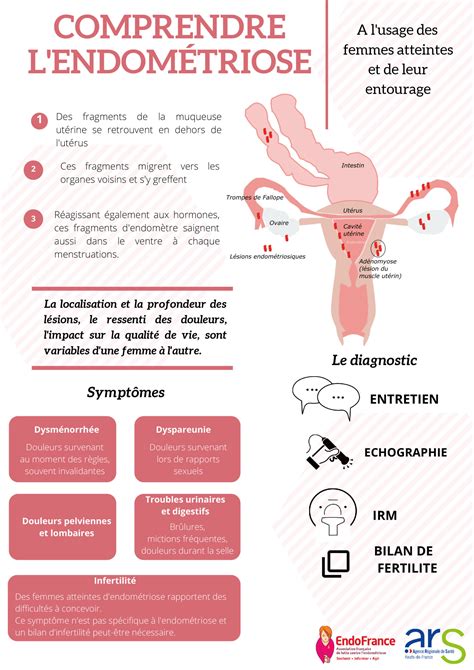 endometriose pdf 2020